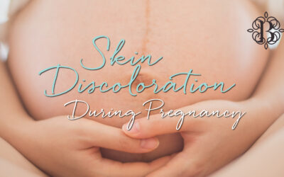 Skin Discoloration During Pregnancy